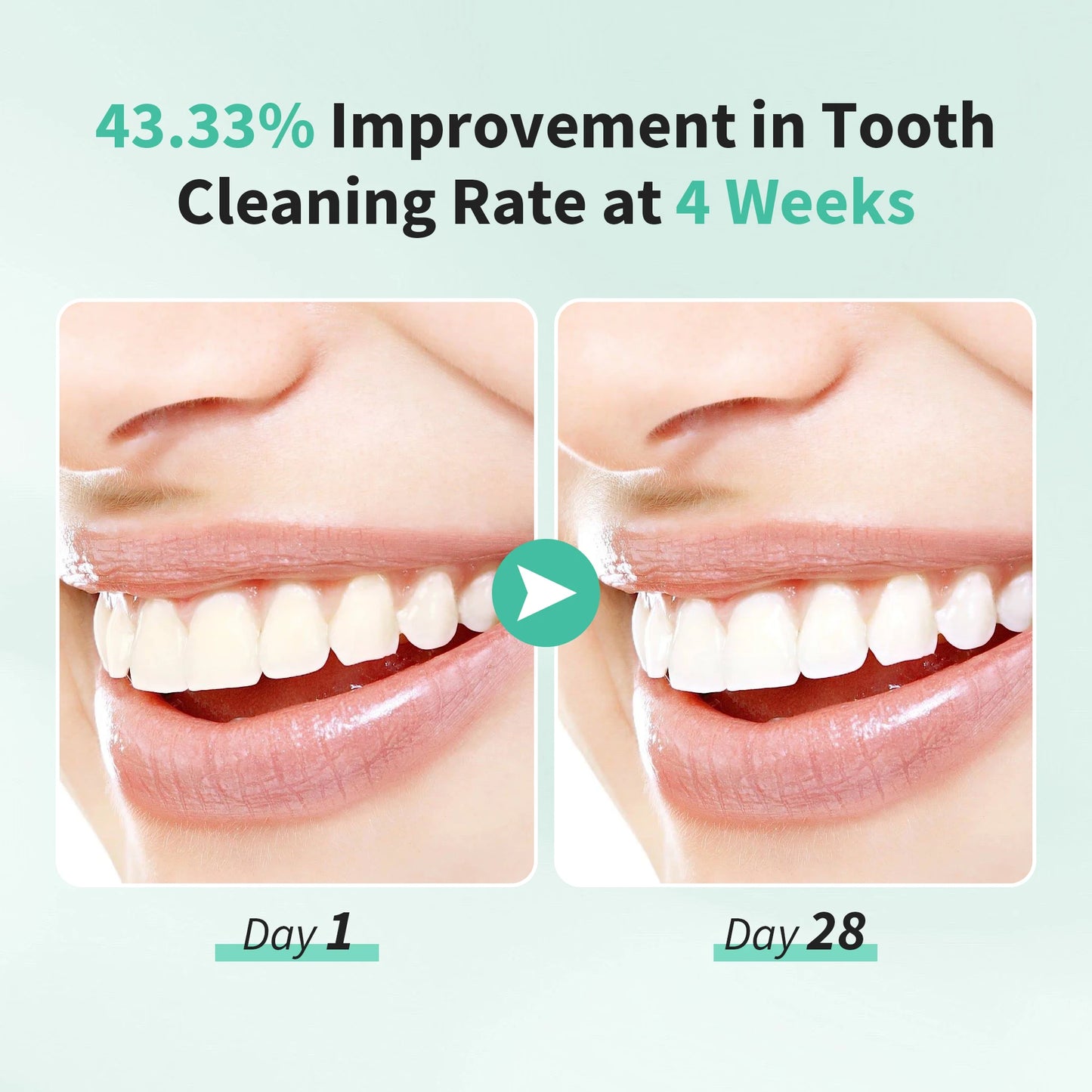 Sejoy BrightSonic Toothbrush