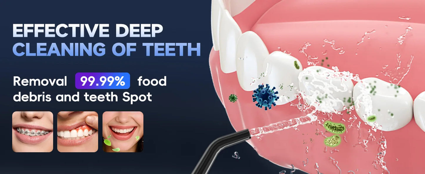 Dental Floss Portable Cordless F18 Oral Irrigator 3 Cleaning Modes Waterproof Rechargeable Dental Cleaner 4 Nozzles Clean Gums