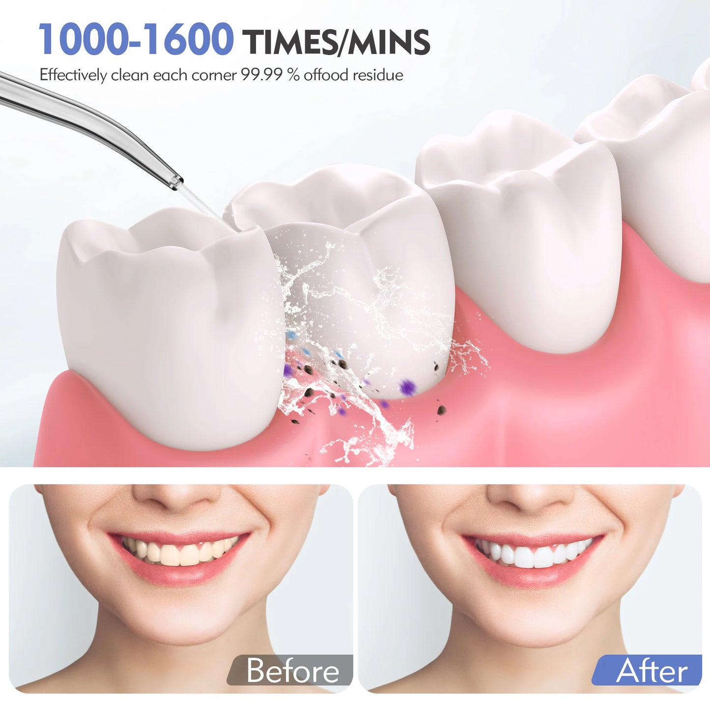 Sejoy AquaCare Flosser