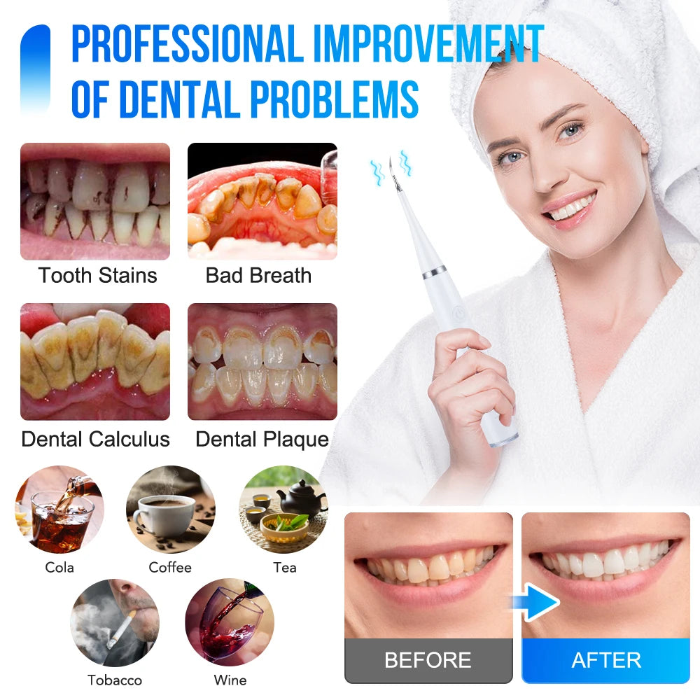 Oral Sonic Dental Cleaner